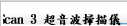 iScan 3 超音波掃描儀